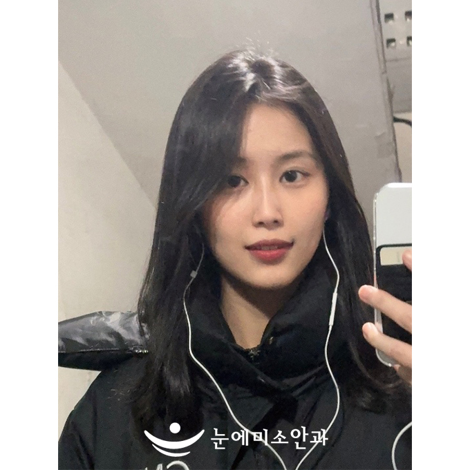 눈에미소안과는 수술 전 검사부터 상담, 수술, 수술 후 관리까지 하나하나 꼼꼼히 봐주시니까 믿고 하시는 걸 추천드립니다.