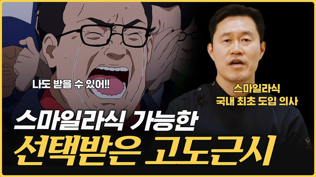 스마일라식을 받을 수 있는 고도근시 조건